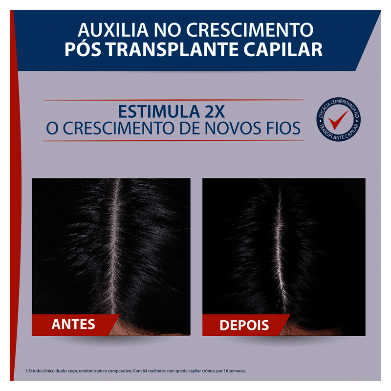 Serum-Antiqueda-Ducray-Neoptide-50mL-3282770153255-6.png